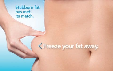 Hips treatment Great Barr From Lipo Sculpt