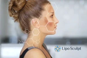 Are you looking at age spots Great Barr removal? Contact Lipo Sculpt today!